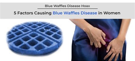 vagina with blue waffle|Blue Waffle Disease 